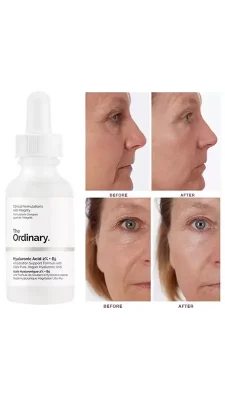 سرم آبرسان هیالورونیک اسید اوردینری اصل Ordinary